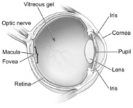 Cataract Image 2